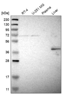 PFTK1 Antibody, Novus Biologicals 25 &mu;L; Unlabeled:Antibodies, Polyclonal